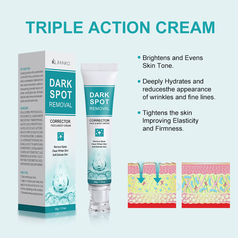 Dark Spot Removal Cream to Remove Dark Spots Freckles Melasma Acne Blot Whitening Skin Care Products